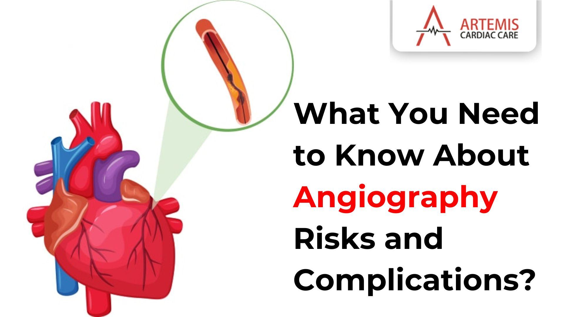 what-types-of-heart-conditions-can-angiography-detect